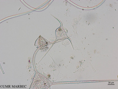 phyto/Brazilian_Nordeste/Northeastcoast_station25/ABRACOS1 October 2015/Tripos horridus (Snap-25)(copy)_thumb.jpg